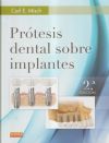 Prótesis Dental Sobre Implantes