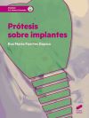 Prótesis Sobre Implantes