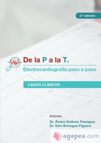 De la P a la T. Electrocardiografía paso a paso. Casos clínicos