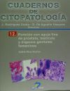 Puncion con aguja fina de prostata, testiculo y organos genitales femeninos cuadernos de citopatologia