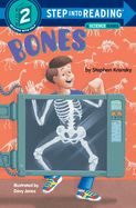 Portada de Bones