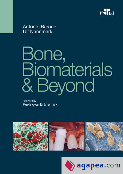 BONE BIOMATERIALS Y BEYOND