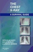 Portada de The Chest X-Ray: A Survival Guide E-Book (Ebook)