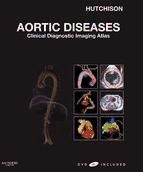 Portada de Aortic Diseases E-Book (Ebook)