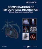 Portada de Complications of Myocardial Infarction E-Book (Ebook)