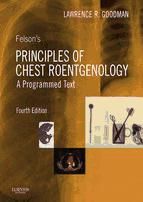 Portada de Felson's Principles of Chest Roentgenology E-Book (Ebook)