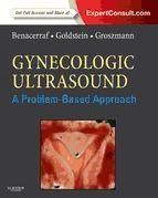 Portada de Gynecologic Ultrasound: A Problem-Based Approach E-Book (Ebook)