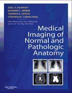 Portada de Medical Imaging of Normal and Pathologic Anatomy E-Book (Ebook)