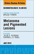 Portada de Melanoma and Pigmented Lesions, An Issue of Dermatologic Clinics - E-Book (Ebook)