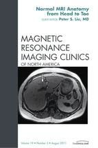 Portada de Normal MR Anatomy, An Issue of Magnetic Resonance Imaging Clinics - E-Book (Ebook)