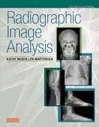 Portada de Radiographic Image Analysis - E-Book (Ebook)