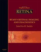 Portada de Ryan's Retinal Imaging and Diagnostics E -Book (Ebook)