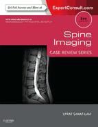 Portada de Spine Imaging E-Book (Ebook)