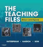 Portada de The Teaching Files: Brain and Spine Imaging E-Book (Ebook)