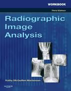 Portada de Workbook for Radiographic Image Analysis - E-Book (Ebook)