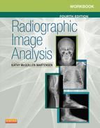 Portada de Workbook for Radiographic Image Analysis - E-Book (Ebook)