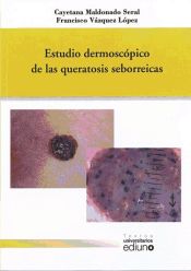 Portada de Estudio dermoscópico de las queratosis seborreicas