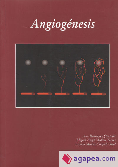 Angiogénesis