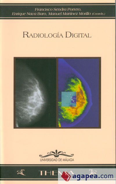 Radiología digital
