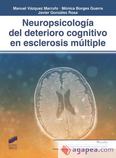 Neuropsicolog&iacute;a del deterioro cognitivo en esclerosis m&uacute;ltiple