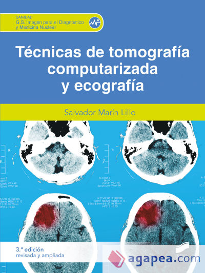 Técnicas de tomografía computerizada (3.ª edición revisada y ampliada)