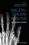 Skeletal Trauma Analysis
