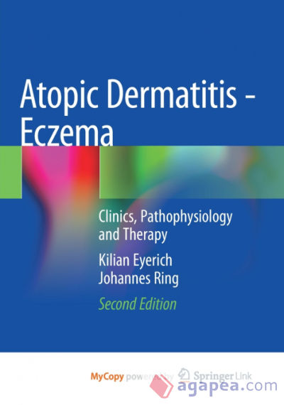 Atopic Dermatitis - Eczema