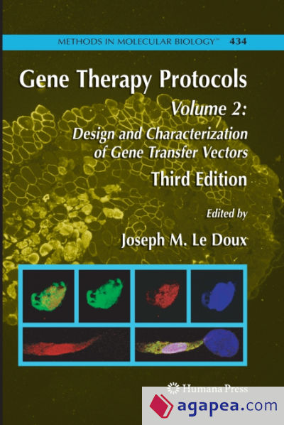 Gene Therapy Protocols