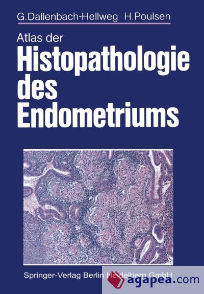 Atlas der Histopathologie des Endometriums