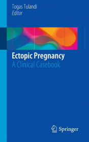 Portada de Ectopic Pregnancy