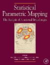 Statistical Parametric Mapping: The Analysis of Functional Brain Images