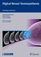 Portada de Digital Breast Tomosynthesis: Technique and Cases