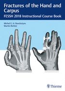 Portada de Fractures of the Hand and Carpus. FESSH 2018 Instructional Course Book