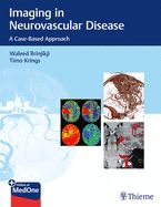 Portada de Imaging in Neurovascular Disease: A Case-Based Approach