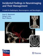 Portada de Incidental Findings in Neuroimaging and Their Management: A Guide for Radiologists, Neurosurgeons, and Neurologists