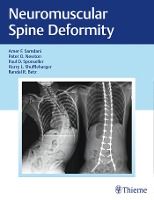 Portada de Neuromuscular Spine Deformity