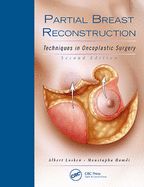 Portada de PARTIAL BREAST RECONSTRUCTION. TECHNIQUES IN ONCOPLASTIC SURGERY + DVD