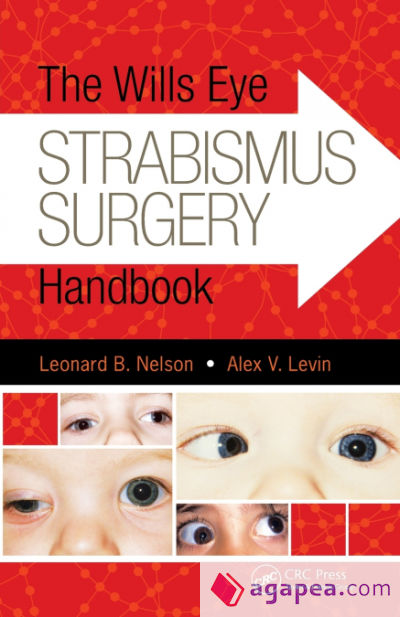 The Wills Eye Strabismus Surgery Handbook