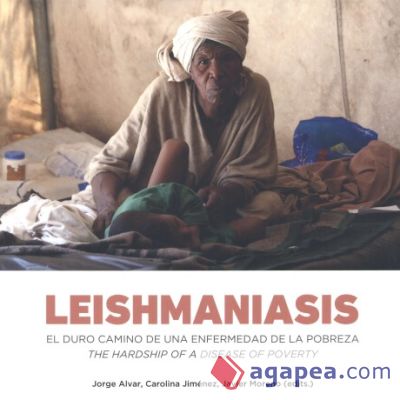 Leishmaniasis