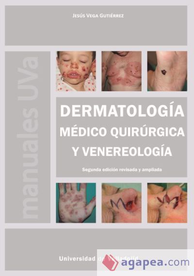 Dermatolog&iacute;a m&eacute;dico quir&uacute;rgica y venereolog&iacute;a