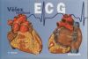 Vélez ECG Handbook