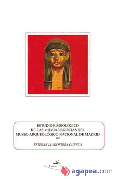 Estudio radiológico de las momias del museo arqueológico nacional de Madrid