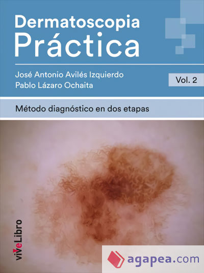 Dermatoscopia Práctica. Vol. 2: Método diagnóstico en dos etapas