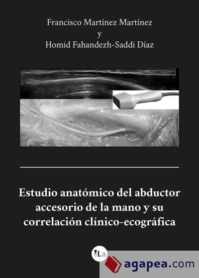 Estudio anatómico del abductor accesorio de la mano y su correlación clínico-ecográfica