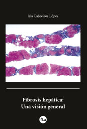 Portada de Fibrosis Hepática. Una visión general