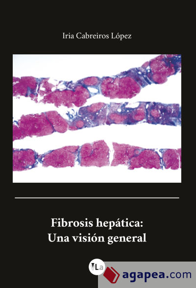 Fibrosis Hepática. Una visión general