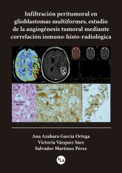 Portada de Infiltracion peritumoral en glioblastomas multiformes, estudio de la angiogénesis tumoral mediante correlación inmuno-histo-radiologica