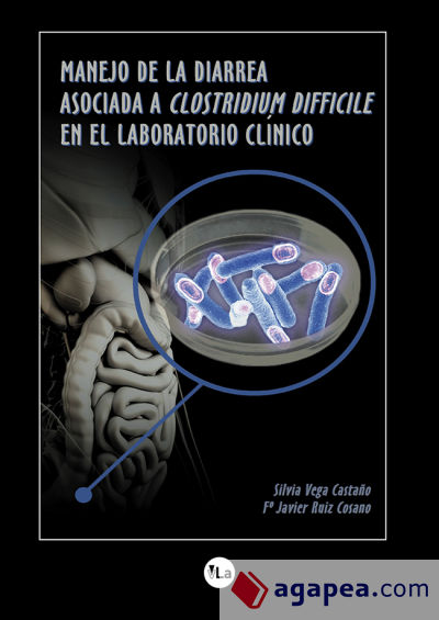 Manejo de la diarrea asociada al Clostridium difficile en el laboratorio clínico