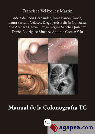 Manual de la Colonografía TC