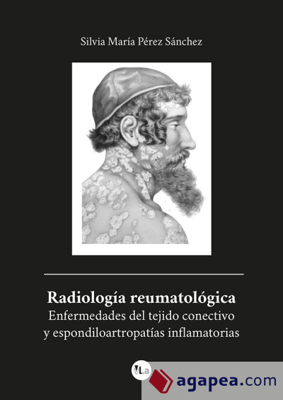 Radiología reumatológica